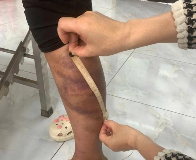 Tạm giữ đối tượng trói, đánh con ruột, hành hạ vợ mang thai  - Ảnh 2.
