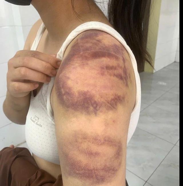 Tạm giữ đối tượng trói, đánh con ruột, hành hạ vợ mang thai  - Ảnh 1.