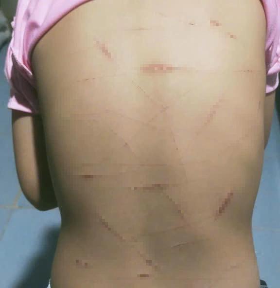 Vụ học sinh lớp 5 ở Cà Mau nghi bị bạo hành: Chưa đủ tuổi xử lý - Ảnh 2.