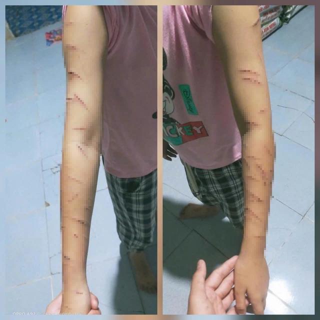 Vụ học sinh lớp 5 ở Cà Mau nghi bị bạo hành: Chưa đủ tuổi xử lý - Ảnh 1.