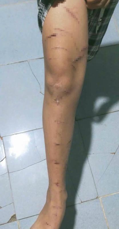 Vụ học sinh lớp 5 ở Cà Mau nghi bị bạo hành: Công an báo cáo vụ việc ban đầu như thế nào? - Ảnh 3.