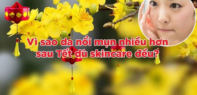 Vì sao da dễ nổi mụn sau Tết dù skincare rất kỹ? - Ảnh 1.