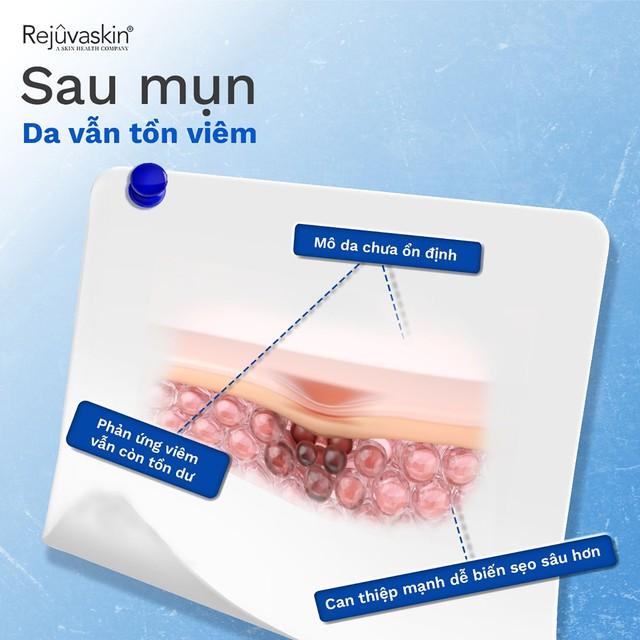  - Ảnh 1.