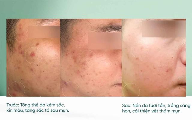 Top 3 serum vitamin C khiến làn da xỉn màu, lão hóa cỡ nào cũng tươi trẻ - Ảnh 3.