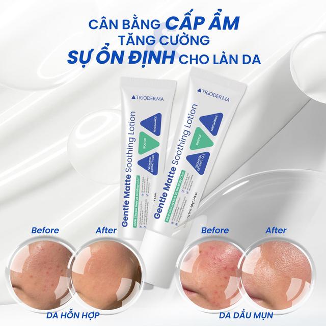 Ra mắt Trioderma Gentle Matte Soothing Lotion mới - kiềm dầu ấn tượng, mỏng mịn nhẹ tênh - Ảnh 2.