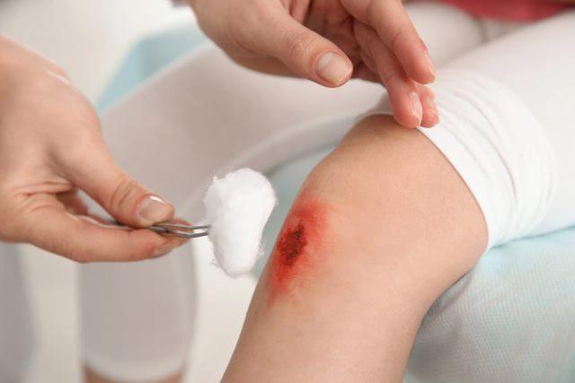 Chuyên gia nói gì về việc chọn kem bôi vết thương để ngừa nhiễm trùng và sẹo? - Ảnh 2.