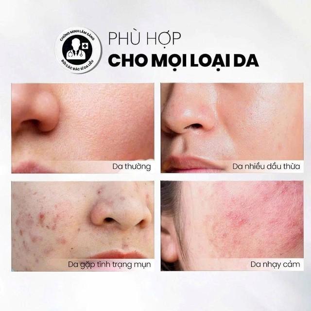 Top 7 sữa rửa mặt cho da dầu mụn sạch sâu, giảm bóng nhờn dù đang hè - Ảnh 5.