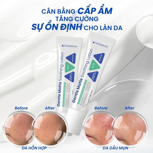 Review Trioderma Gentle Matte Soothing Lotion: Bỏ qua bước này da khó ổn định, khỏe đẹp?- Ảnh 7.