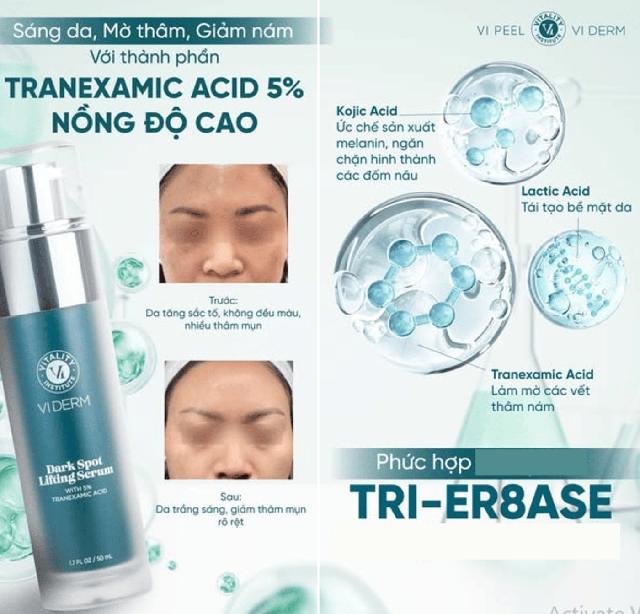 Top 5 serum giúp ‘tạm biệt’ nám, thậm chí nám hỗn hợp tưởng như chưa tồn tại - Ảnh 3.