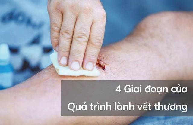 Chuyên gia giải đáp: Vết thương hở nên bôi gì để tránh sẹo xấu? - Ảnh 2.