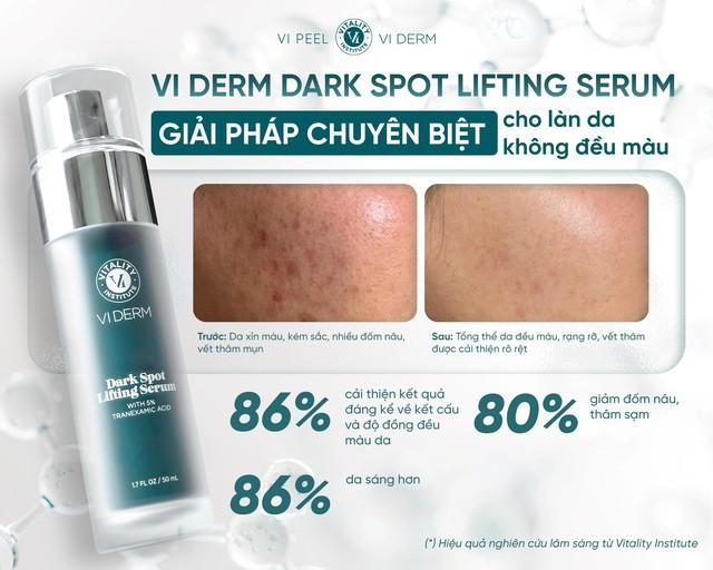 Top 5 serum giúp ‘tạm biệt’ nám, thậm chí nám hỗn hợp tưởng như chưa tồn tại - Ảnh 4.