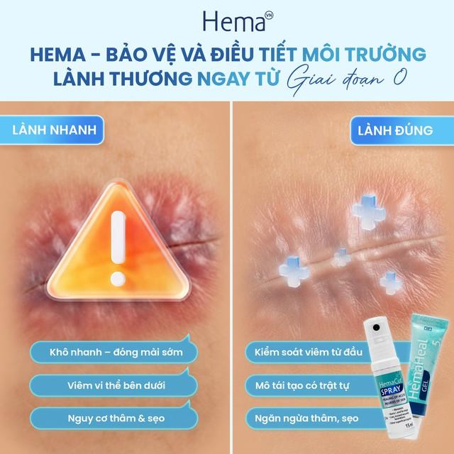 Chuyên gia giải đáp: Vết thương hở nên bôi gì để tránh sẹo xấu? - Ảnh 8.