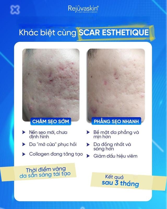  - Ảnh 3.