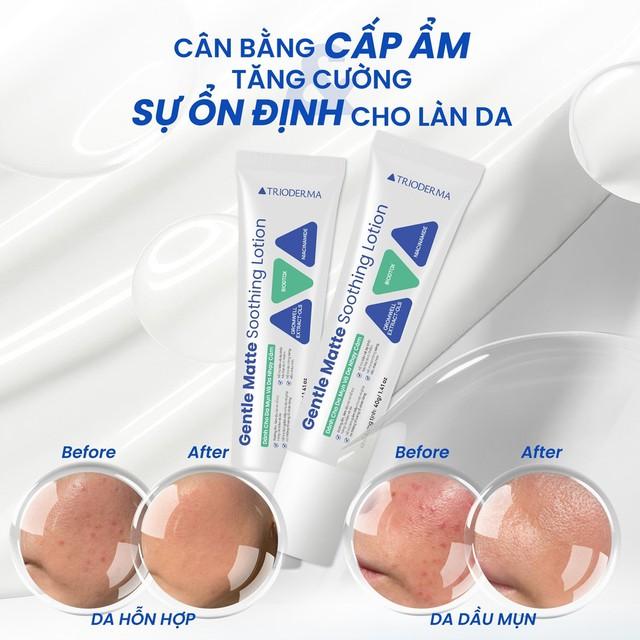 Giải mã Trioderma Gentle Matte Soothing: Lotion chuẩn y khoa ổn định nền da khỏe từ gốc - Ảnh 1.