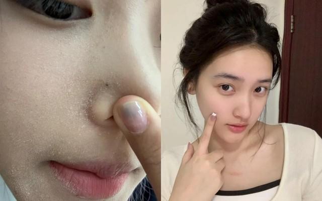 Top 5 serum cấp ẩm đang cháy hàng vì giúp da căng bóng như dùng filter - Ảnh 1.
