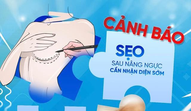 Phẫu thuật thẩm mỹ ngực: Đừng để hành trình tìm lại tự tin ‘đứt gánh’ vì sẹo - Ảnh 1.