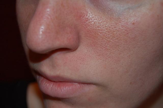 Cảnh báo: 5 dấu hiệu da thiếu collagen ‘trầm trọng’ mà 99% chị em đều bỏ qua- Ảnh 2.