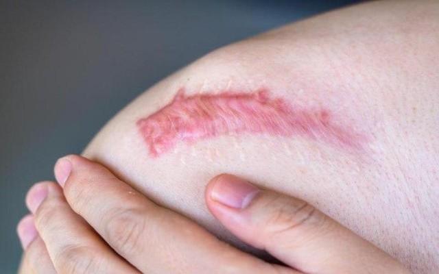 Vì sao phục hồi hậu thẩm mỹ cần một chiến lược ngay từ đầu?- Ảnh 2.