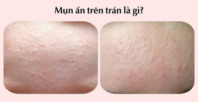 Kem chấm mụn trên trán nào có lượt bán top đầu TikTok hiện nay?- Ảnh 2.