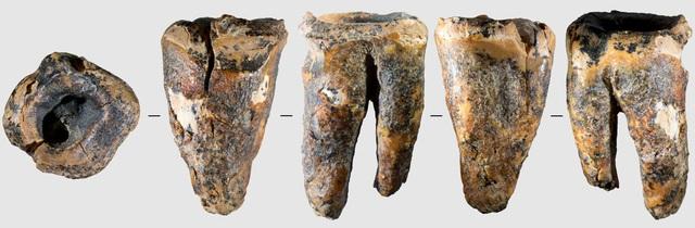 59.000 năm trước, người Neanderthal đã biết trị sâu răng? - Ảnh 2.