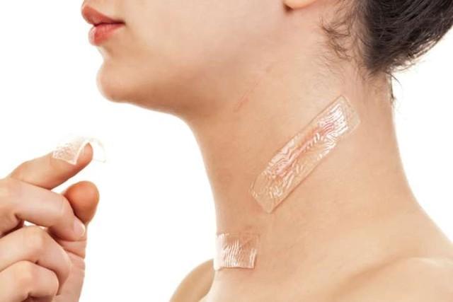 Tốn tiền triệu mà sẹo vẫn không xẹp vì cách dùng miếng dán ép sẹo sai - Ảnh 3.