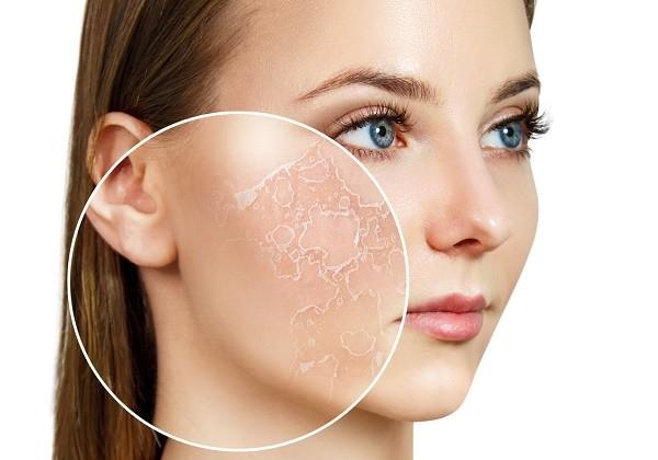 Cảnh báo: 5 dấu hiệu da thiếu collagen ‘trầm trọng’ mà 99% chị em đều bỏ qua- Ảnh 3.