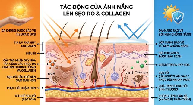 Vì sao trị sẹo rỗ mãi không khỏi? 90% người đang mắc sai lầm nghiêm trọng - Ảnh 3.
