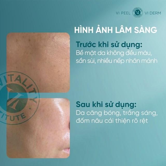 Tưởng filter, ai ngờ U40 trẻ như 20 nhờ 3 kem trắng da chống lão hóa này!- Ảnh 3. Tưởng filter, ai ngờ U40 trẻ như 20 nhờ 3 kem trắng da chống lão hóa này!- Ảnh 3.