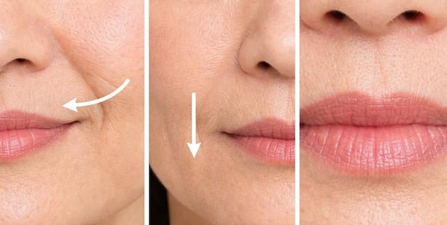 Cảnh báo: 5 dấu hiệu da thiếu collagen ‘trầm trọng’ mà 99% chị em đều bỏ qua- Ảnh 4.