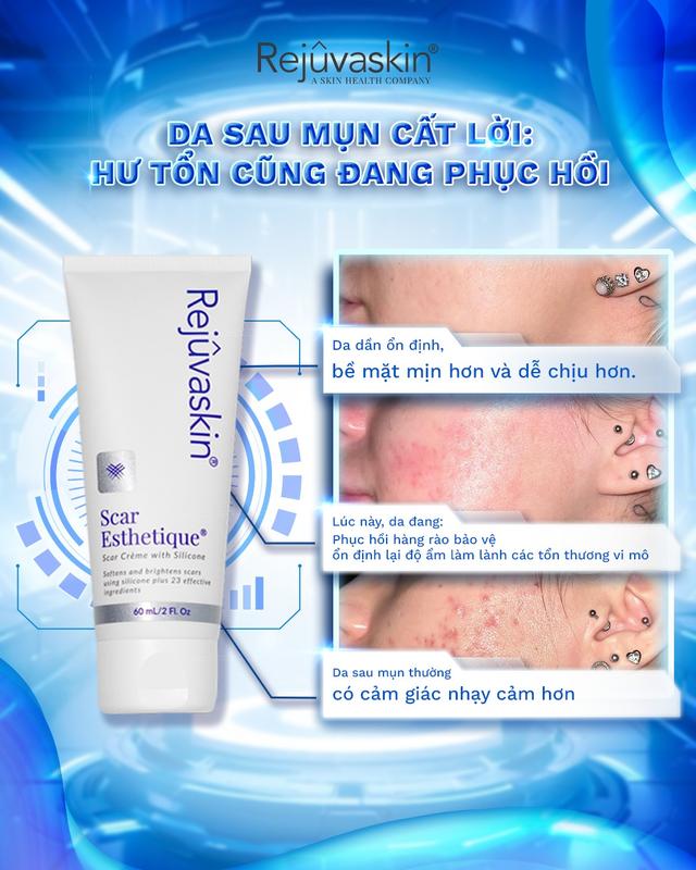 Vì sao trị sẹo rỗ mãi không khỏi? 90% người đang mắc sai lầm nghiêm trọng - Ảnh 4.
