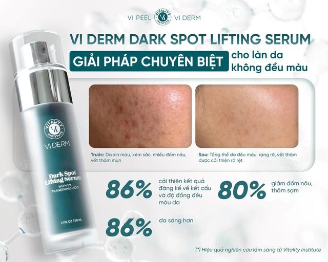 5 serum mờ nám lâu năm không cần laser: Làm mờ đốm nâu, làn da trắng sáng - Ảnh 5.