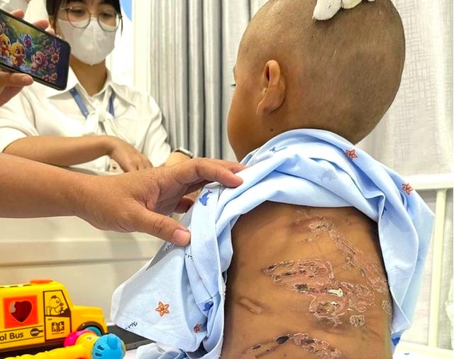Đừng im lặng, hãy cứu mạng sống của trẻ em qua tổng đài 111 - Ảnh 1.