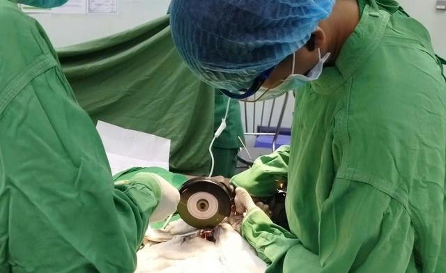 Suýt phải cắt bỏ dương vật bị 2 con ốc kim loại siết chặt - Ảnh 1.