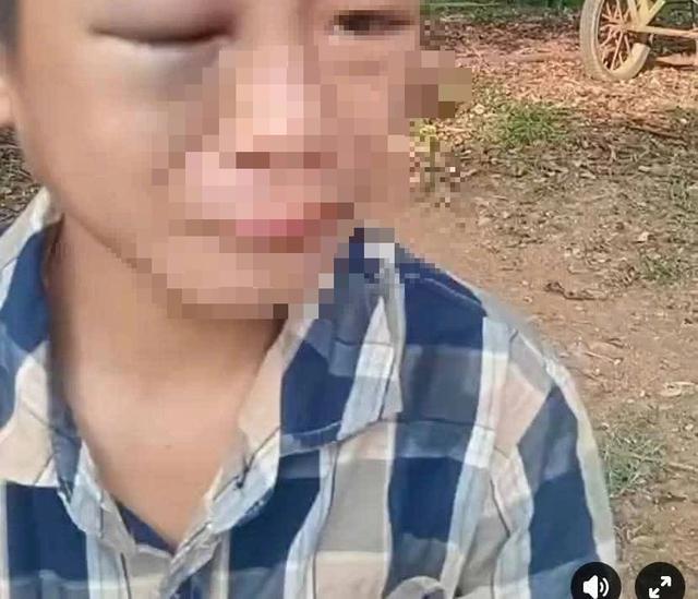 Xác minh vụ bé trai nghi bị mẹ kế và bố đánh đập dã man - Ảnh 1.
