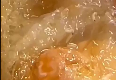 Dòi bò lúc nhúc trong hộp xôi mua tại tiệm bánh mì ở Quảng Trị- Ảnh 1.