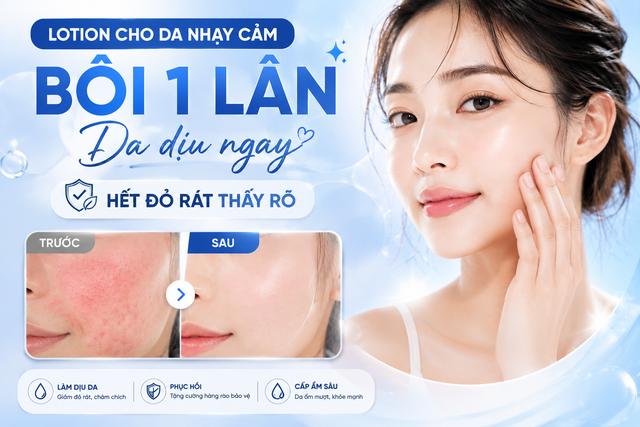 Lotion cho da nhạy cảm: Bôi 1 lần, giúp làm dịu da, giảm đỏ rát thấy rõ- Ảnh 1.