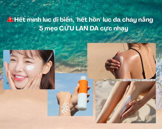 Hết mình lúc đi biển, 'hết hồn' lúc cháy nắng: 5 mẹo cứu làn da cực nhạy - Ảnh 1.