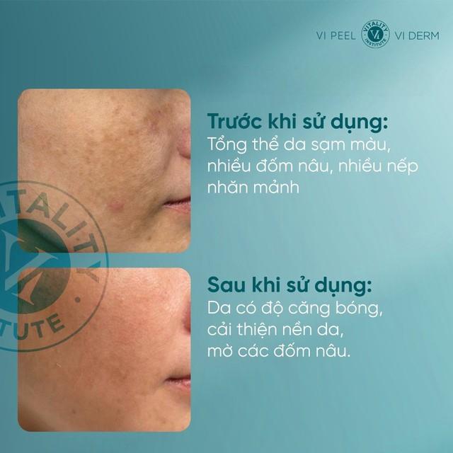 Top 5 retinol cho da lão hóa U.30+ ‘trẻ hóa’ tưởng như U.20 sau khoảng 4 tuần- Ảnh 4.