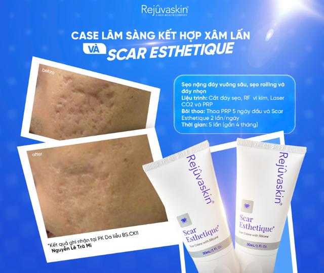 Review chi tiết kem Scar Esthetique làm mờ sẹo rỗ do mụn có tốt không?- Ảnh 7.